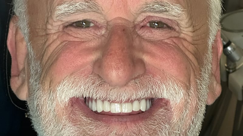 After full mouth reconstruction case 2